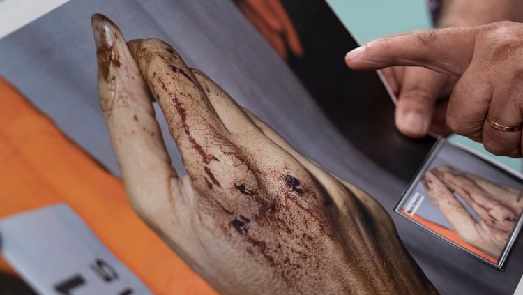 Las manos de Nisman cuyos restos fueron peritados