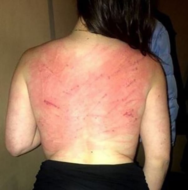 Esta mujer de 28 años también recibió 80 latigazos en público (Instagram)