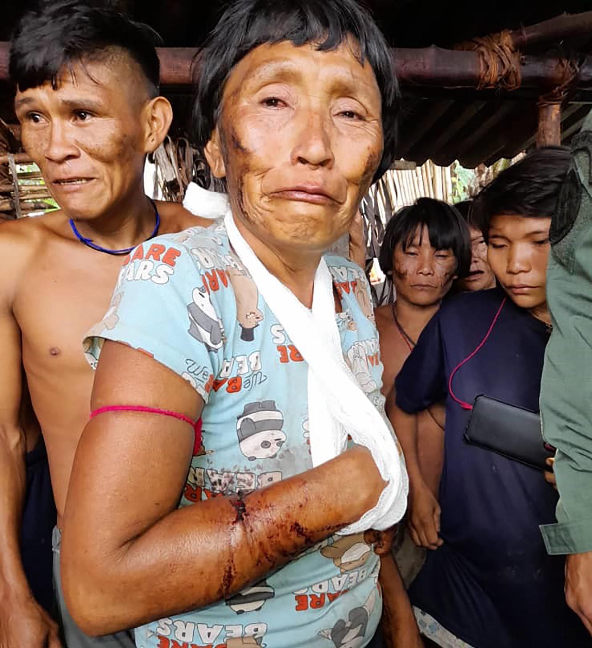 24 marzo 22 INFOBAE Yanomamis