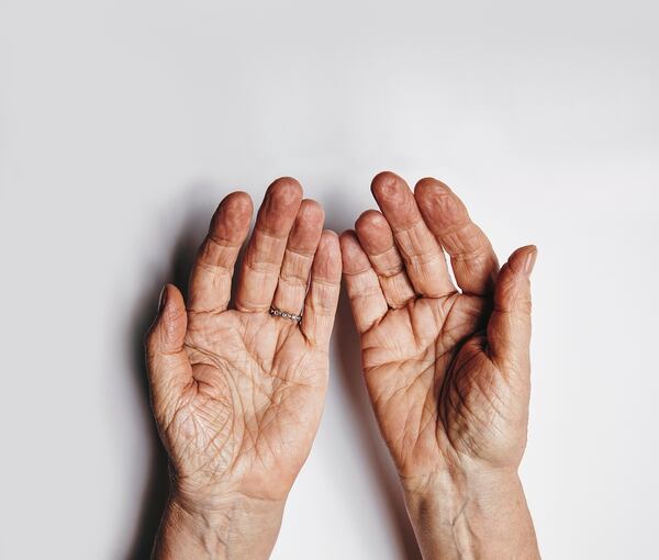 Uno de los primeros signos de envejecimiento prematuro de la piel es la notable pérdida de la tez brillante, combinada con círculos oscuros, líneas finas o piel seca y menos elástica (Getty Images)