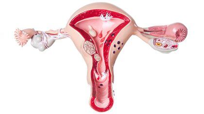 La transposición uterina es un tratamiento que sirve para aquellas mujeres que están en edad fértil, y por algún problema oncológico necesitan recibir radioterapia en la pelvis (Getty)