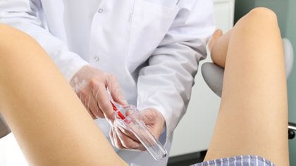 La prueba de Papanicolaou es un método sencillo para diagnosticar las úlceras cervicales;  Debe hacerse anualmente entre las edades de 21 y 65 (Shutterstock)