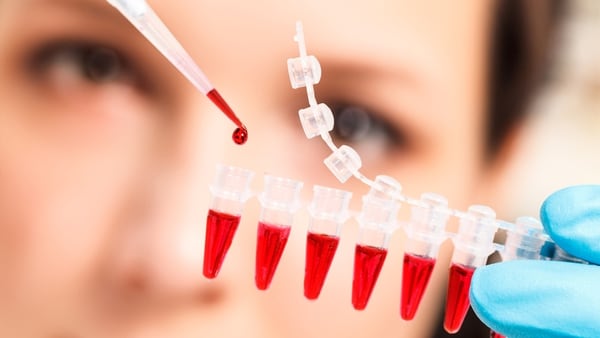 La sangre es un recurso importante también para detectar tumores (Shutterstock)