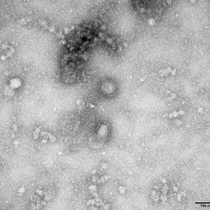 Una transmisión electrónica por microscopía del coronavirus obtenido por los CDC de China (China CDC via GISAID/Handout via REUTERS)