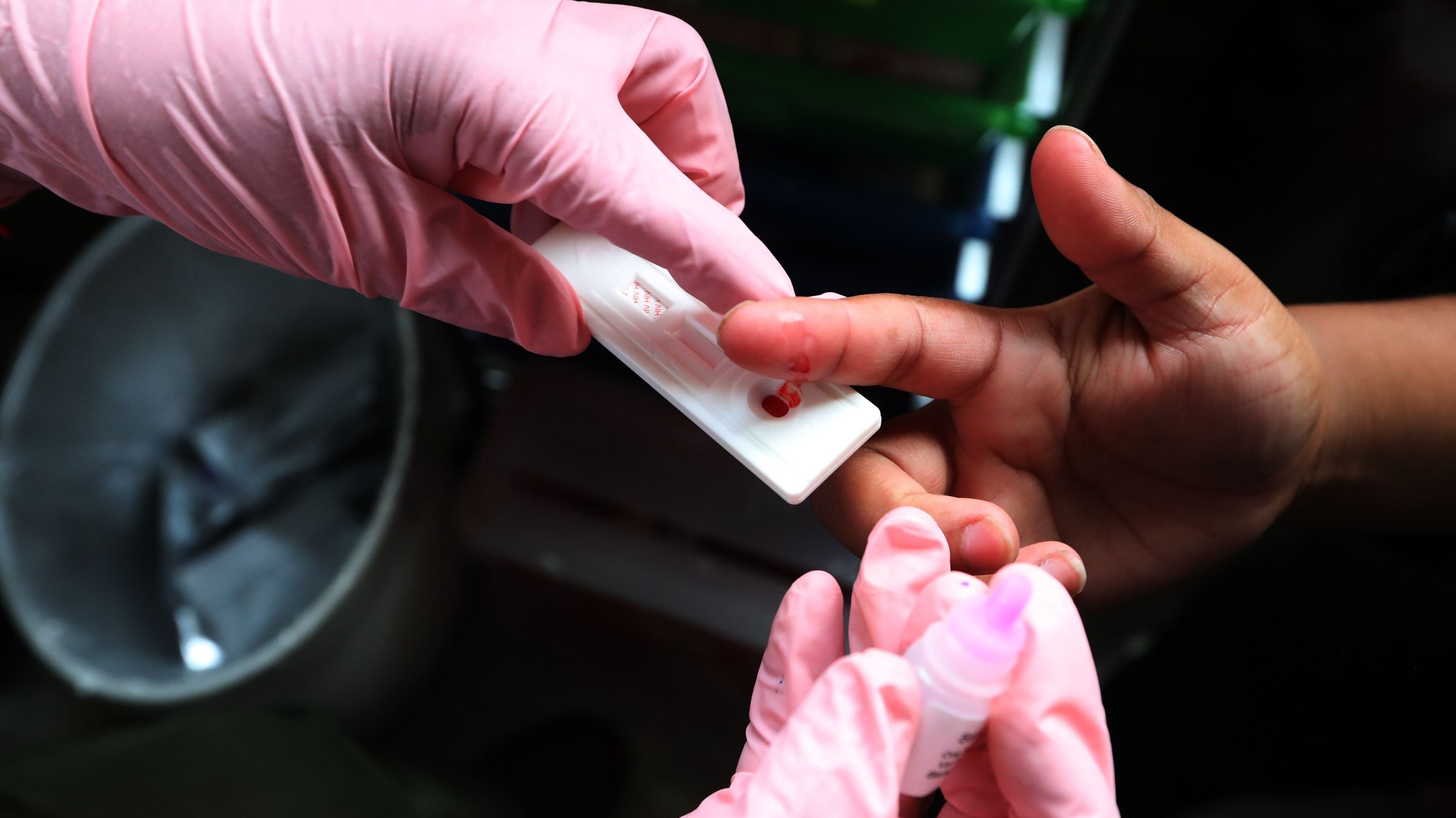 Es clave intensificar los diagnósticos de VIH en la población (EFE/Mario Guzmán)
