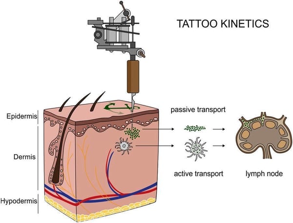 Tras la inyección de tinta de tatuaje, las partículas pueden ser transportadas pasivamente a través de la sangre y de los fluidos linfáticos, o fagocitadas por células inmunes y, posteriormente, depositadas en los ganglios linfáticos regionales. Una vez se cura el tatuaje, las partículas siguen presentes en la dermis y en los sinusoides de los ganglios linfáticos secos