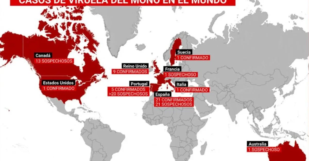 Monkeypox: l’OMS a convoqué une réunion d’urgence alors que les cas se propagent dans le monde