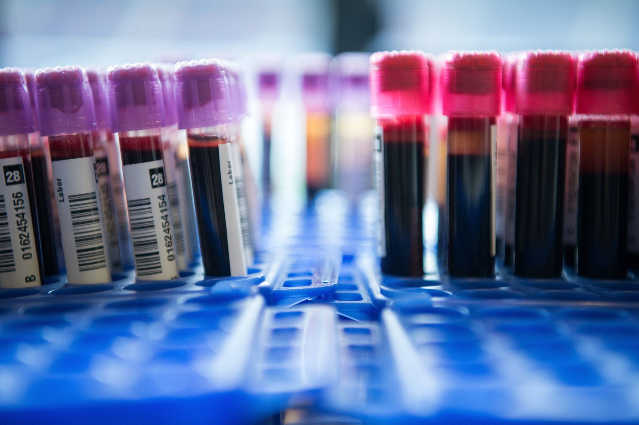 Un análisis de sangre sirve para detectar y para hacer un seguimiento de las enfermedades (DPA)