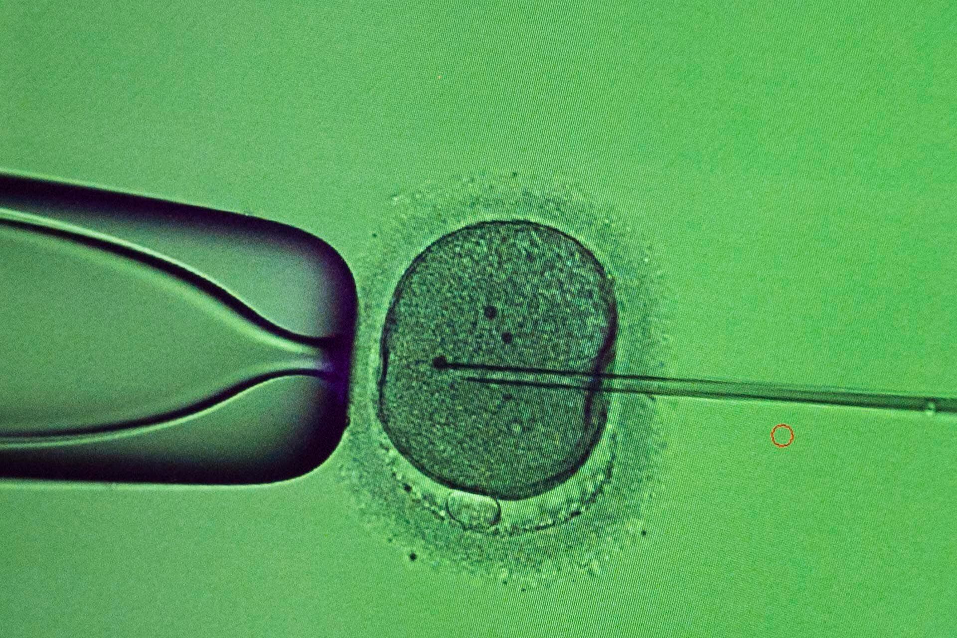 El embrión sintético es sin dudas un logro científico que abre nuevas posibilidades en la medicina
(AP Photo/Roman Hrytsyna)