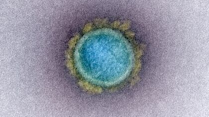 Uno de los grupos de drogas interrumpe la traducción del mensaje del genético del coronavirus a la célula para su reproducción. (NIAID Integrated Research Facility (IRF)/Handout via REUTERS)