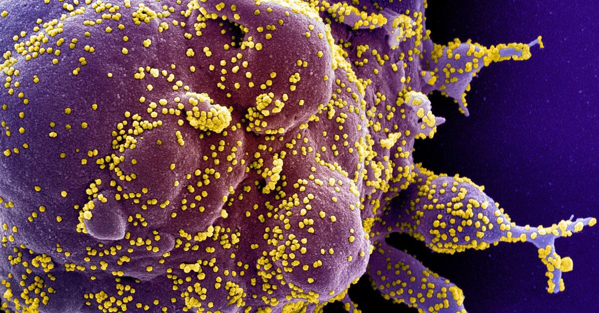 Photo of Los científicos advierten que el coronavirus podría transportar material genético a los cromosomas humanos