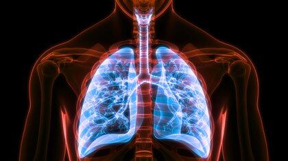 Se trata de una patología que afecta principalmente las vías respiratorias, lo que genera obstrucción bronquial y, que si bien se puede prevenir, una vez que aparece no es totalmente reversible (Shutterstock)