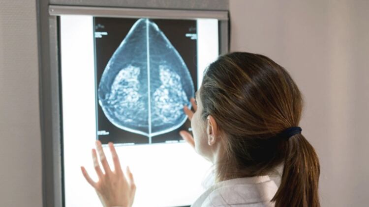 Aproximadamente 1 de cada 8 mujeres en los Estados Unidos (casi un 12%) desarrolla cáncer de mama invasivo en el transcurso de su vida (Foto: Archivo)