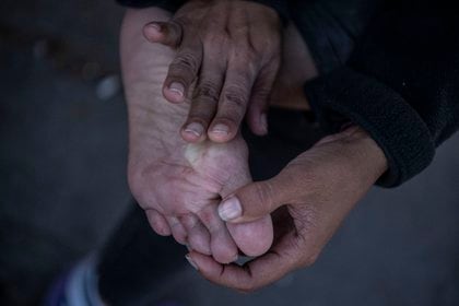 La migrante venezolana Anyier, de 40 años, se masajea los pies luego de caminar durante muchas horas por la carretera camino a Iquique, luego de cruzar desde Bolivia, en Huara, Chile, el 18 de febrero de 2021 (MARTIN BERNETTI / AFP)