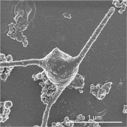 Un escaneo electrónico y microscópico de una célula infectada por el coronavirus COVID-19 (Hiroyuki Imachi, Masaru K. Nobu and JAMSTEC/Handout via REUTERS)