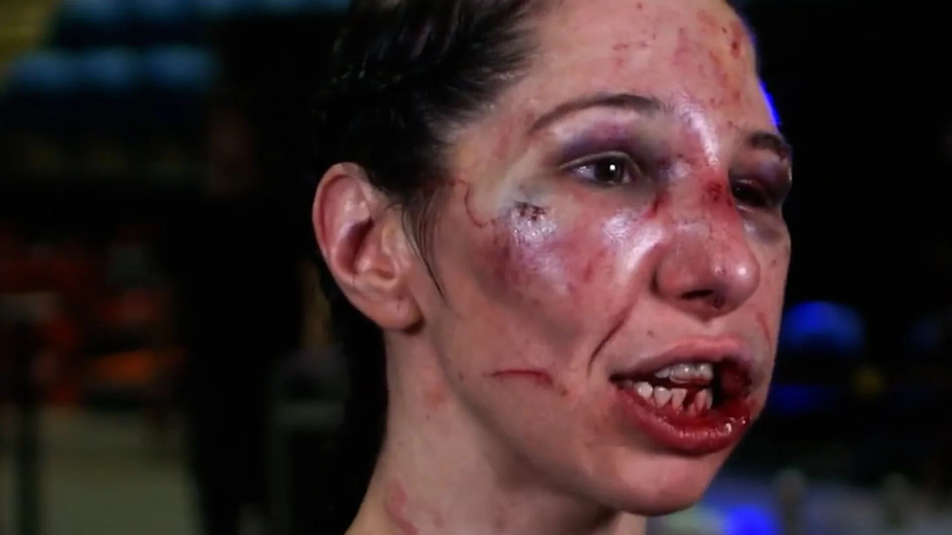 La insólita declaración de la luchadora que perdió dos dientes en una sangrienta pelea de MMA: “Disfruté de todo el proceso”