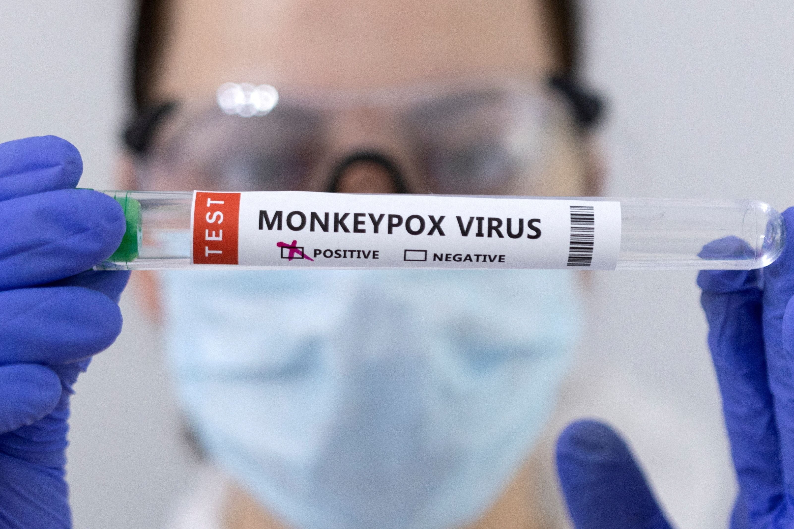 Más de 34.000 personas han sido ya diagnosticadas con la viruela del mono o viruela símica. en más de 90 países en el mundo desde mayo pasado/ REUTERS/Dado Ruvic/Archivo