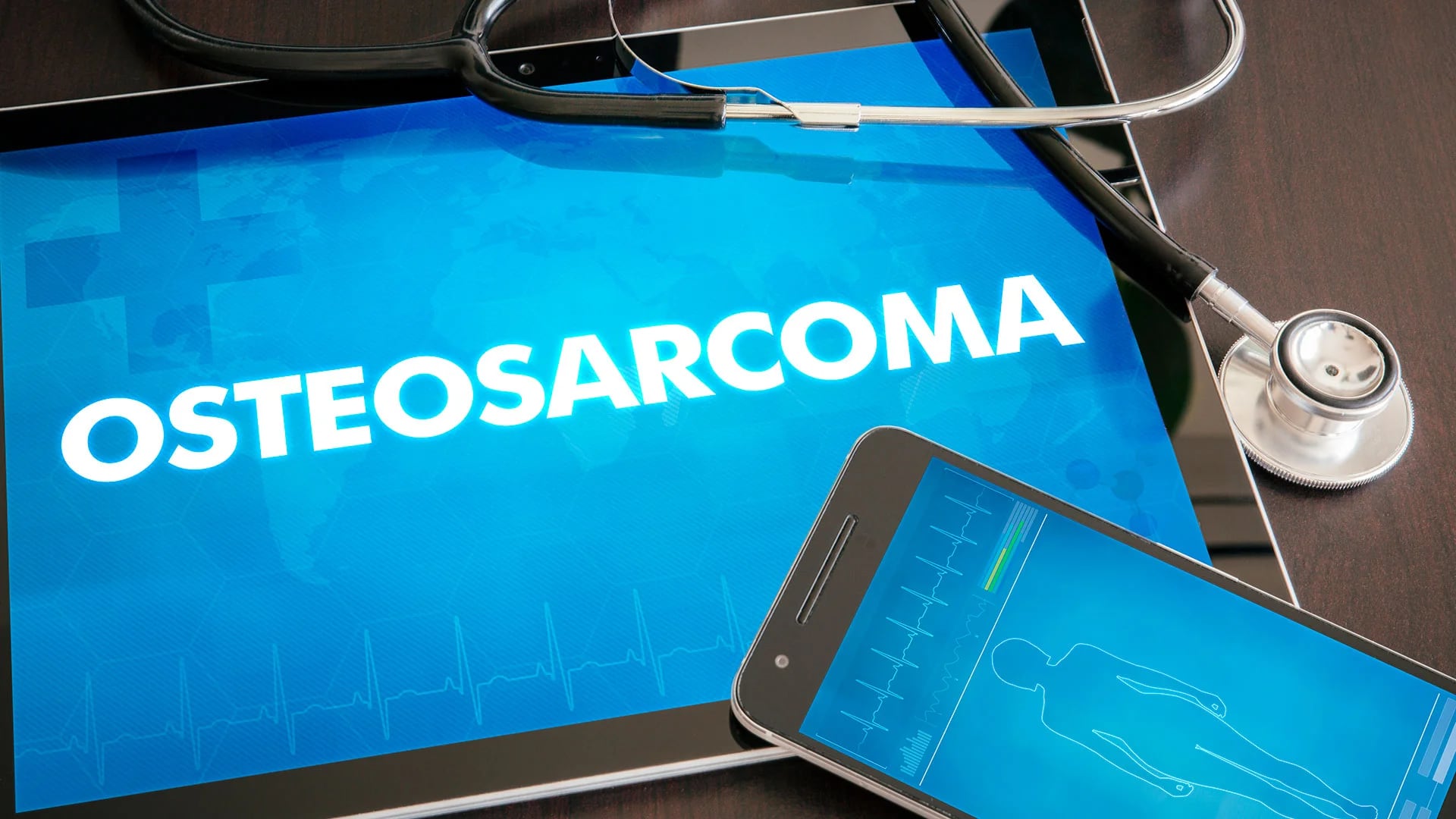 El promedio en la Argentina es de aproximadamente 40 casos de osteosarcoma al año (Shutterstock)