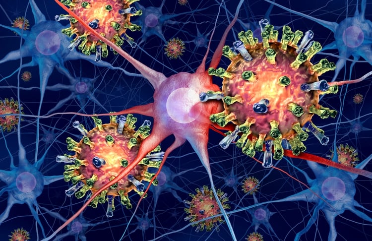 El virus del sarampión en el cerebro infecta neuronas microscópicas (Shutterstock)
