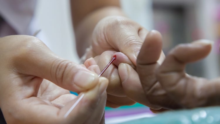  En los últimos 25 años, más de 30.000 voluntarios formaron parte de diferentes estudios de vacunas contra el VIH a nivel mundial (Shutterstock.com)