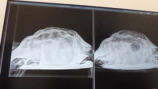 ImÃ¡genes de la tortuga -en principio pequeÃ±a- que los mÃ©dicos encontraron en el Ã¡rea genital de la vÃ­ctima