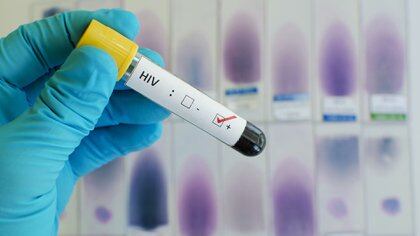 El lanzamiento de un novedoso e innovador tratamiento contra el VIH se realizó en el marco del “XVII Simposio Científico Fundación Huésped” (Shutterstock)