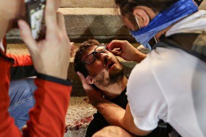Un herido en los choques es atendido por otros manifestantes (REUTERS/Marko Djurica)