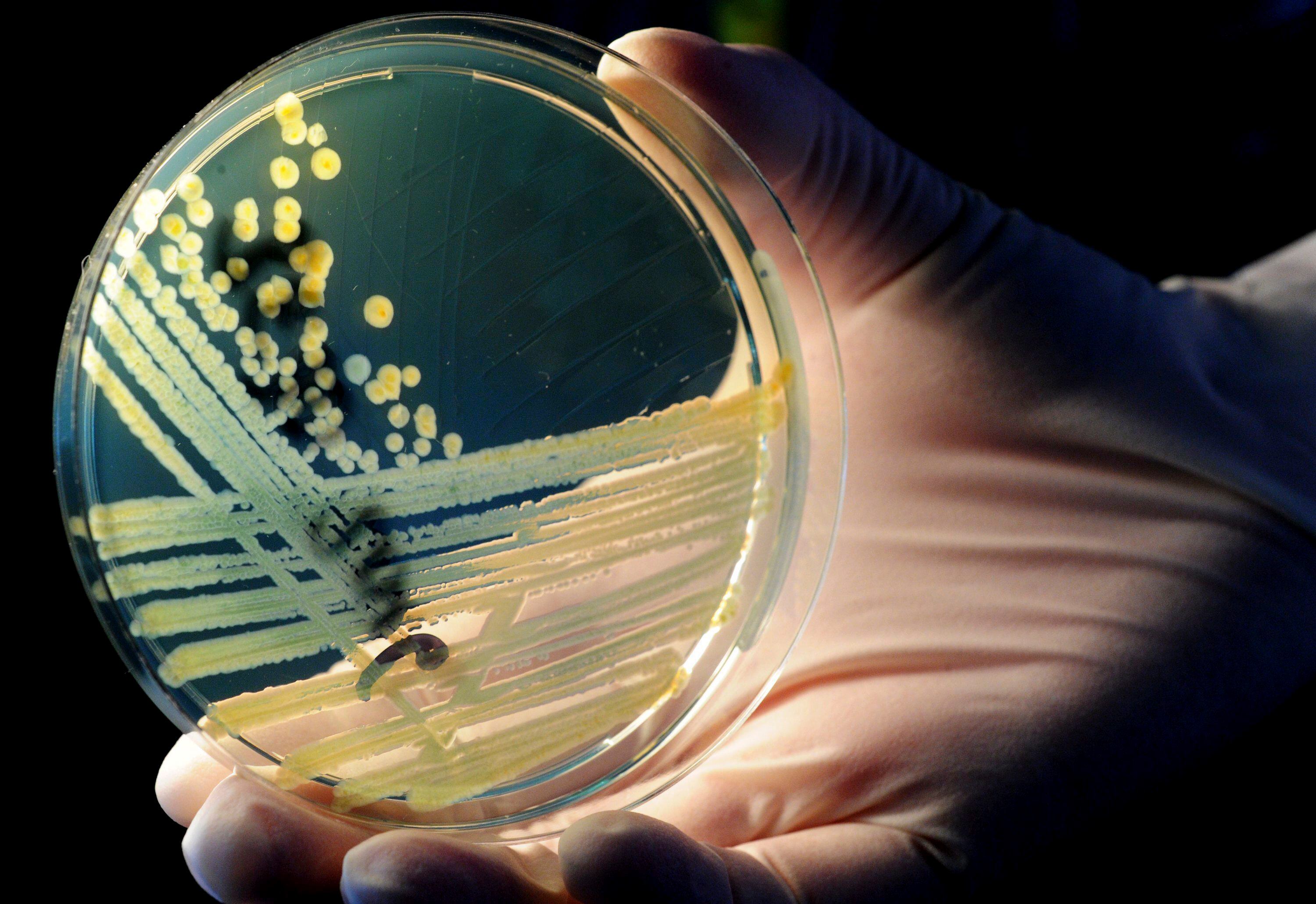 La lucha contra la resistencia a los antimicrobianos busca alternativas para salvar vidas ante el avance de las superbacterias EPA/Julian Stratenschulte/Archivo 