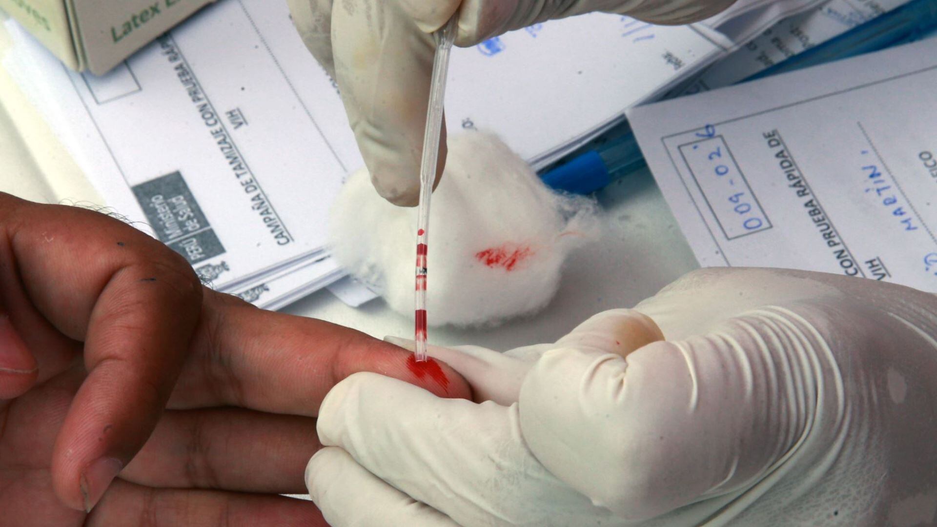Examen de sangre por el dedo