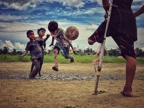 El tercer clasificado en esta categoría fue Zarni Myo Win (Myanmar) con la foto “I want to play” (Quiero jugar) que tomó con un iPhone 7 Plus en Yangon, Myanmar. “Un niño que perdió una pierna miraba a sus amigos jugar fútbol y dijo que quería jugar al fútbol”, dijo Zarni sobre esta imagen.