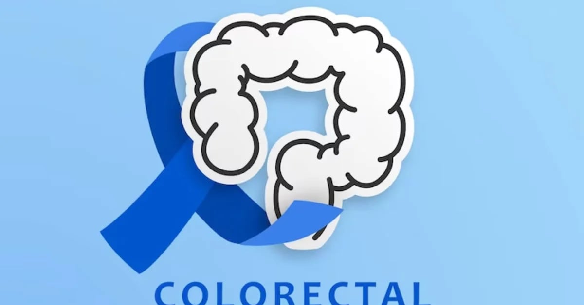 What is colon cancer and why it is important to detect it in time, according to a specialist from UNAM
