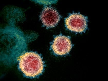 El SARS-CoV-2 aislado de un paciente en los EE. UU. Se muestran partículas de virus emergiendo de la superficie de células cultivadas en el laboratorio. Los picos en el borde exterior de las partículas del virus dan a los coronavirus su nombre, en forma de corona (NIAID-RML a través de Reuters)