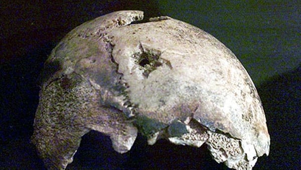 El cráneo que le atribuyeron a Hitler y resultó siendo de una mujer