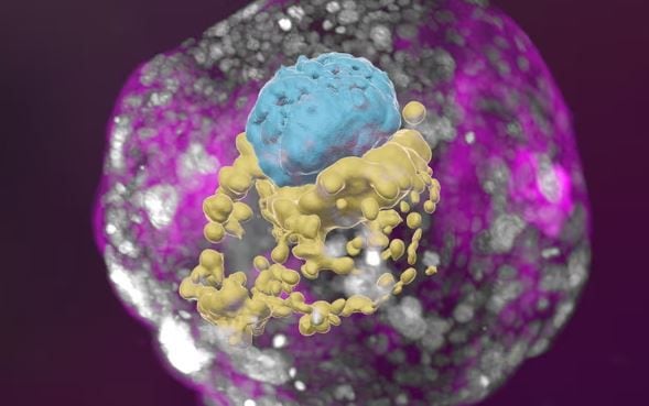 Un modelo de embrión basado en células madre humanas en el día 8. El amarillo marca el saco vitelino y el rosa es el trofoblasto 
(Jacob Hanna/Instituto Weizmann de Ciencias)