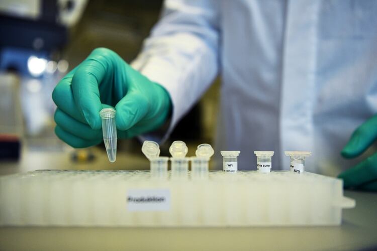 FOTO DE ARCHIVO: Un empleado de la compañía biofarmacéutica alemana CureVac, demuestra el flujo de trabajo de investigación sobre una vacuna contra la enfermedad por coronavirus (COVID-19) en un laboratorio en Tuebingen, Alemania. Este laboratorio no participó, sin embargo, de esta investigación (Reuters)