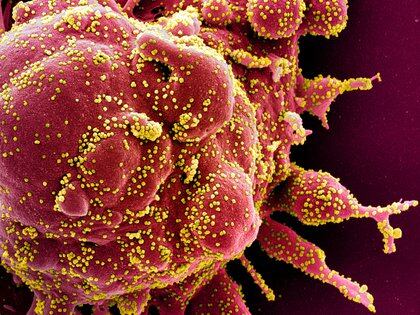 El coronavirus SARS-CoV-2 visto bajo un microscopio electrónico de alta resolución - REUTERS