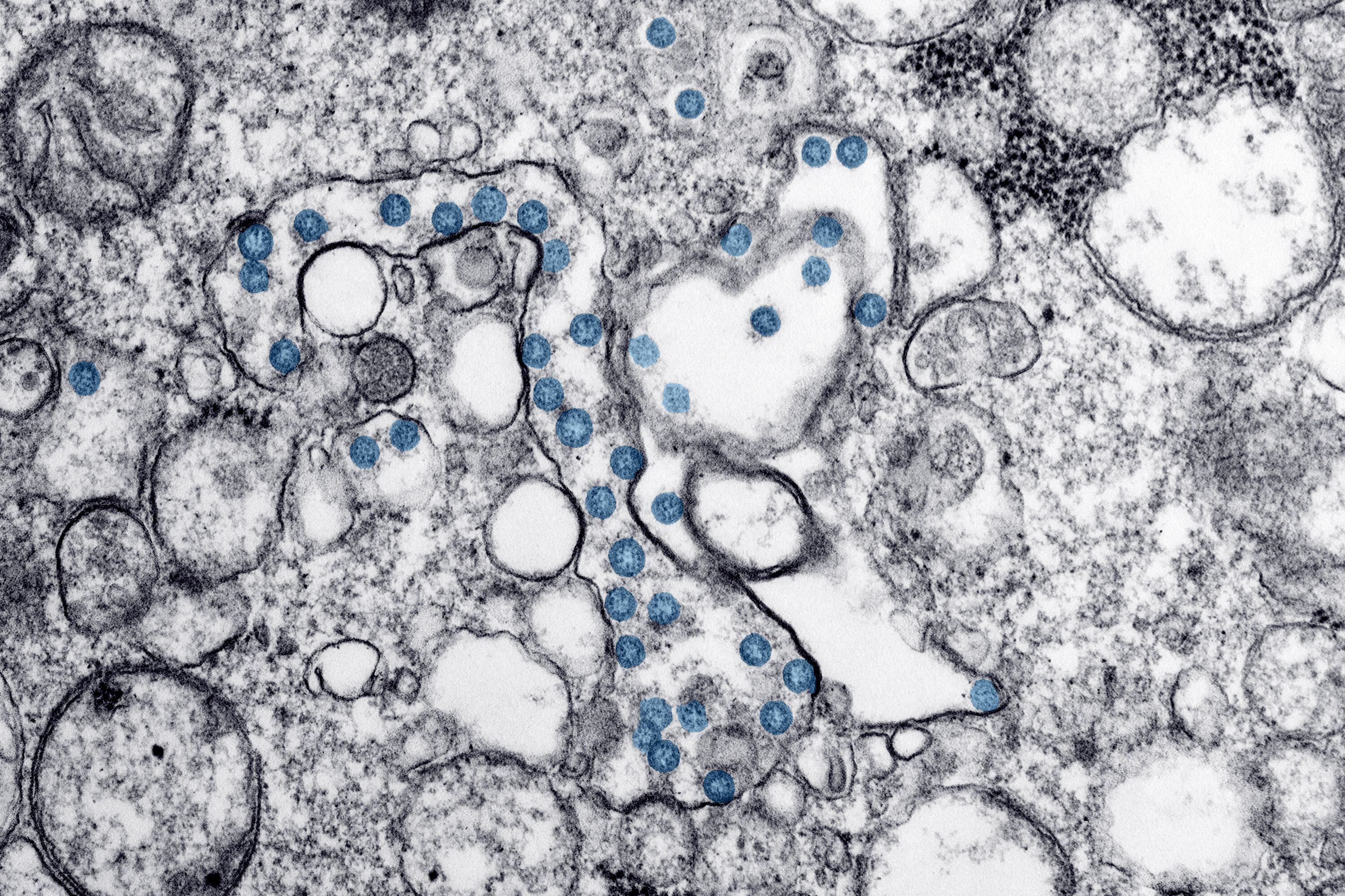 El SARS-CoV-2 es observado en un microscopio electrónico en un laboratorio de EEUU (Foto: REUTERS)