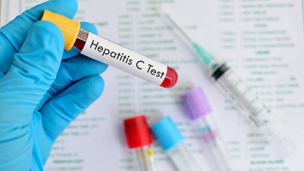 Todas las personas deberían pedir a su médico, al menos una vez en su vida, las pruebas para hepatitis A, B y C (Getty)