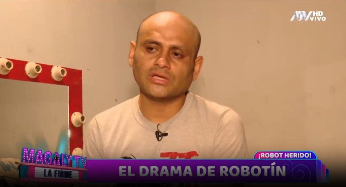 Robotín enfrenta drama por complicaciones de diabetes y revela falta de apoyo de amigos de la televisión. (Captura: Magaly TV La Firme)