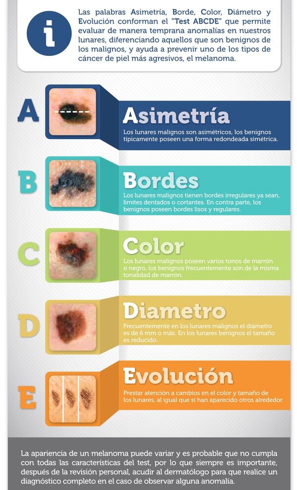 El método ABCDE para revisar lunares y manchas de la piel (MSD Oncología)