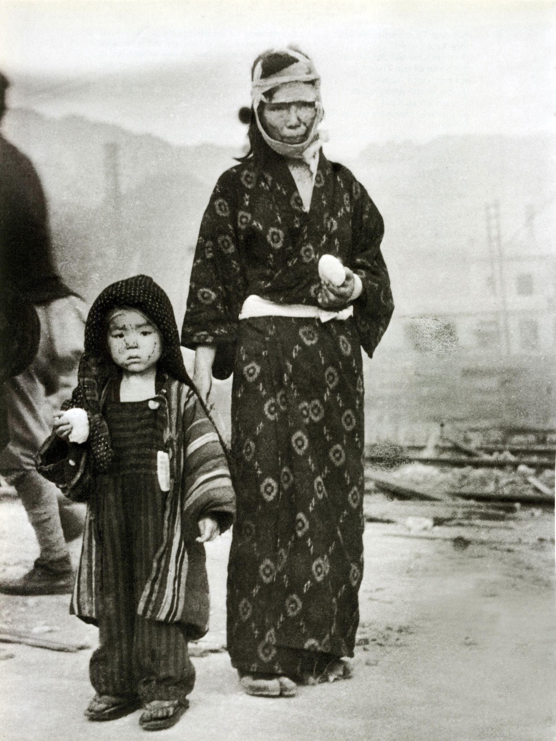 Una niña con su madre en Nagasaki la mañana siguiente al lanzamiento de la bomba atómica, el 10 de agosto de 1945. Su casa fue destruida, están a 1,5 km al sureste núcleo de la explosión y les han dado una bola de arroz como alimento (Galerie Bilderwelt/Getty Images)