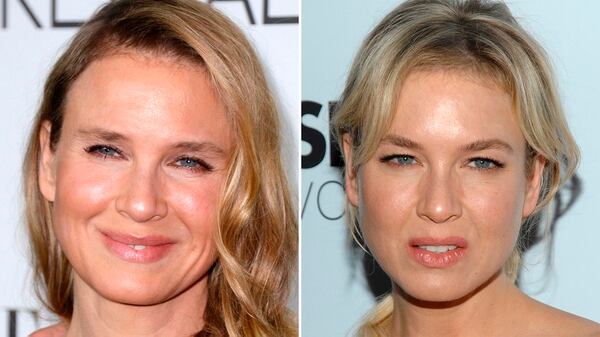 Las consecuencias de las cirugías en el rostro de Renée Zellweger