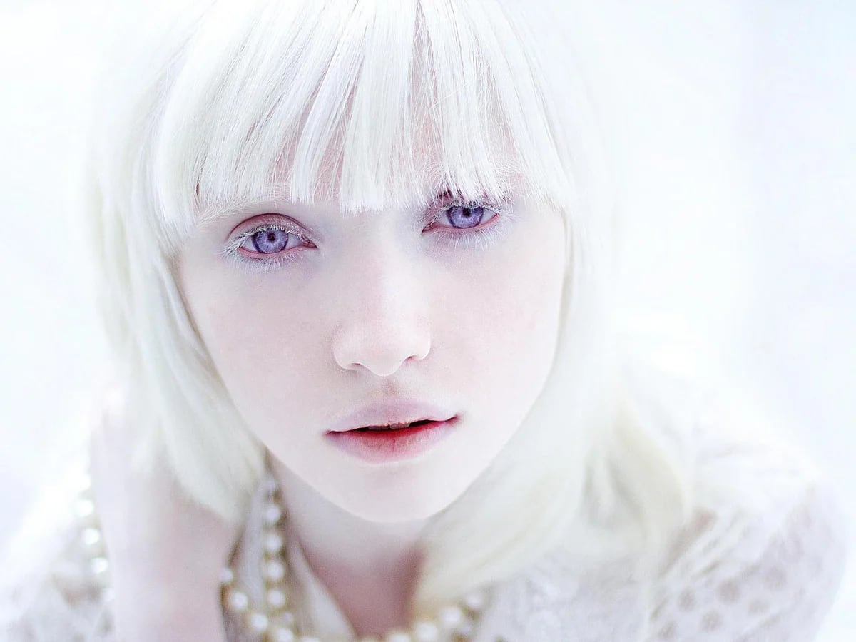 Top 82+ imagen modelo albina famosa