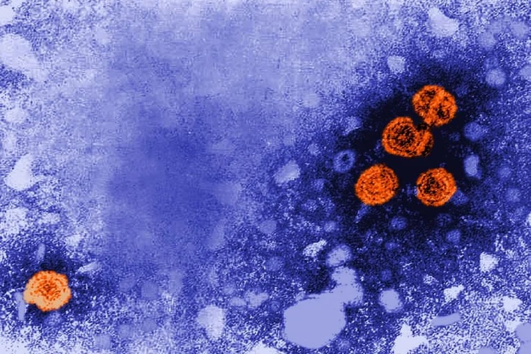 Imagen de microscopía electrónica de transmisión coloreada digitalmente revela la presencia de viriones de la hepatitis  