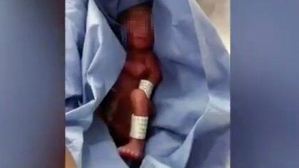 El pequeño Lázaro lloraba y se movía cuando fue encontrado por su padre en la morgue Foto: captura de pantalla.