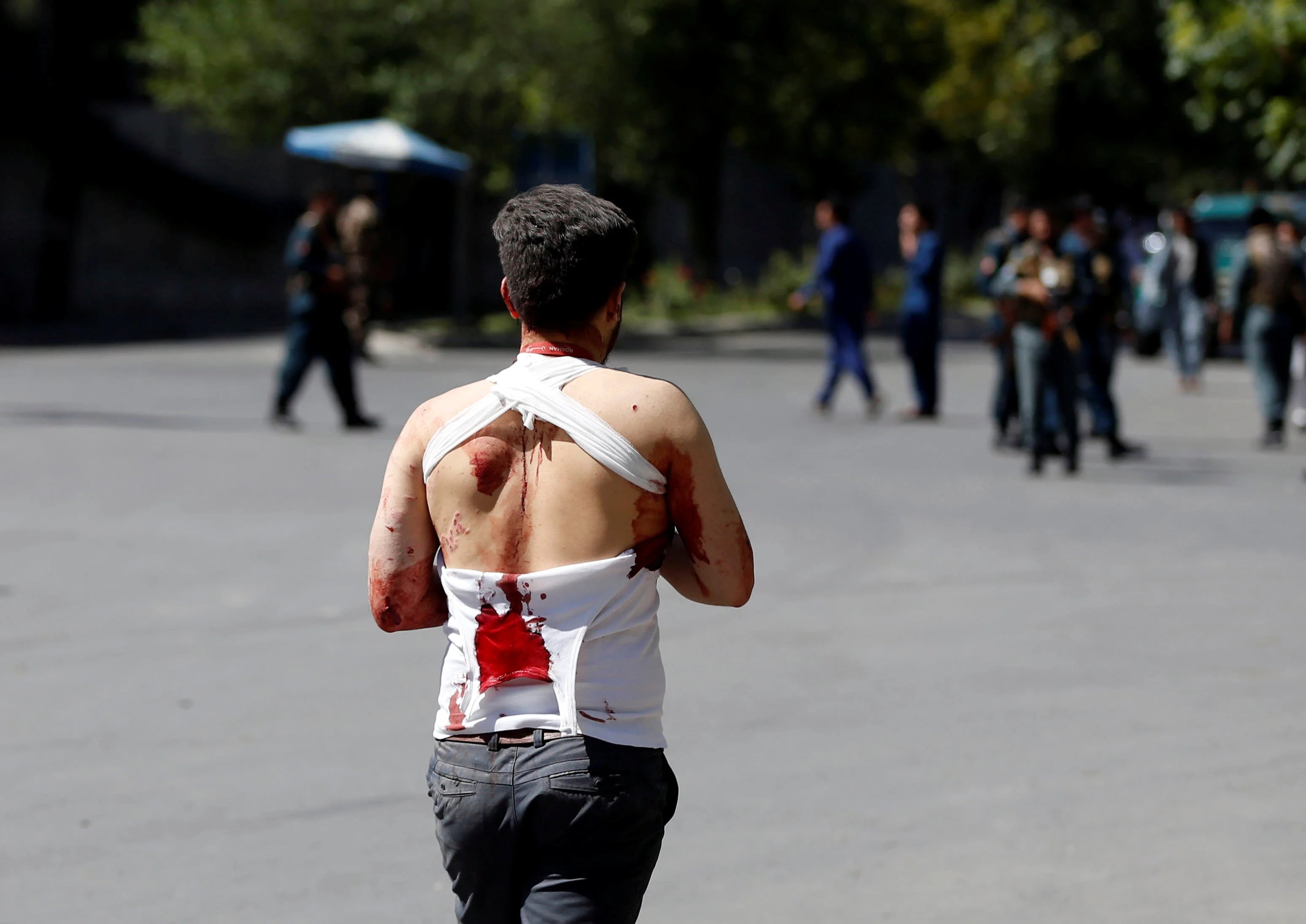 Un hombre herido y ya vendado tras la explosión en Kabul (Reuters)