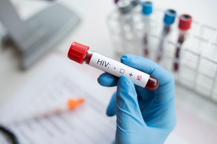 Diagnóstico sosteniendo una prueba de VIH positivo (Foto: Shutterstock)