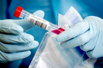 La dependencia estricta de la confirmación por PCR de la eliminación del ARN viral crea otros problemas, como la limitación del acceso a la atención médica para los nuevos pacientes con enfermedades agudas (Efe)