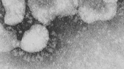 El primer coronavirus, identificado por Jane Almeida 