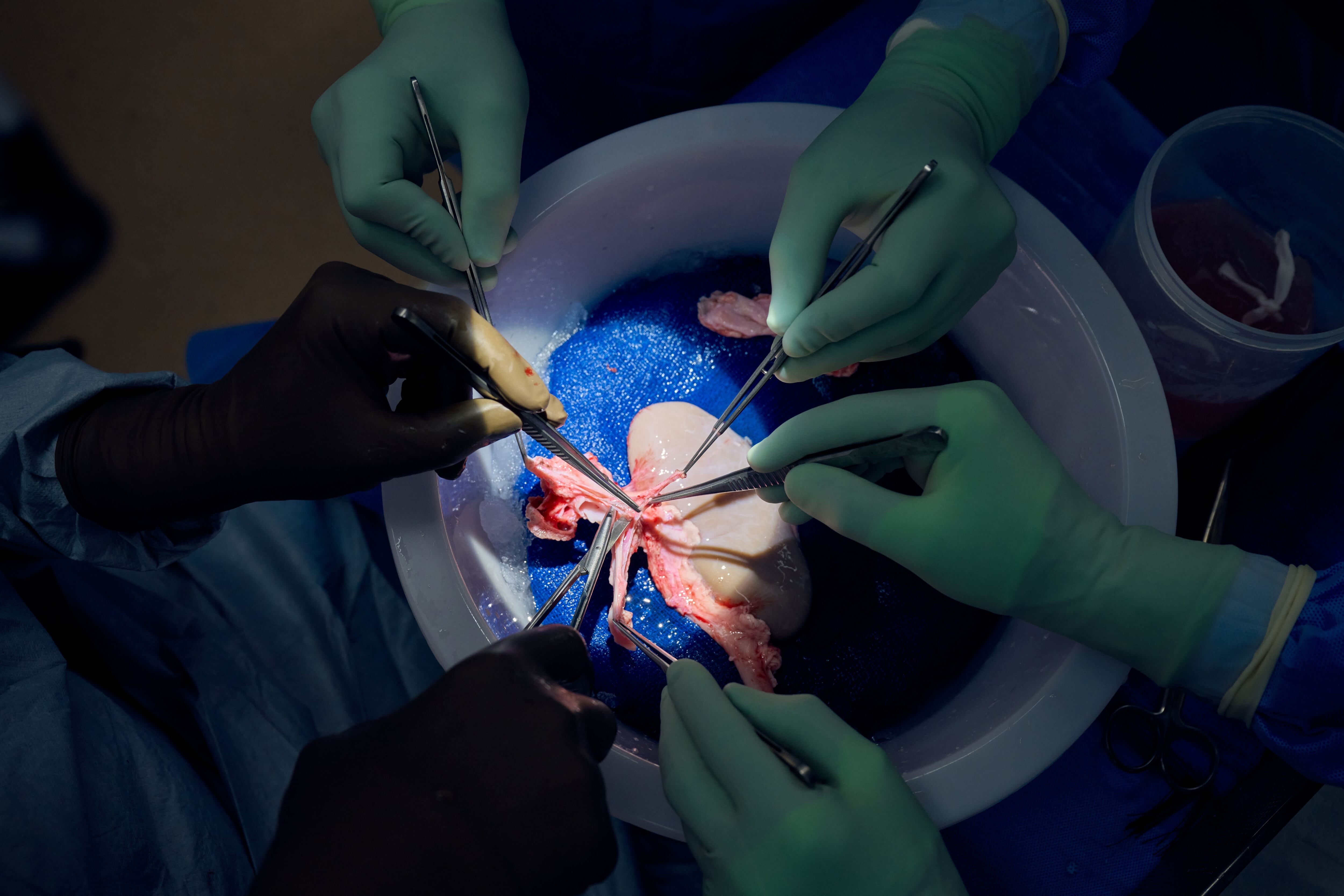 Caption: Tissue from the pig kidney is examined and removed in preparation for transplant.  Credit: Joe Carrotta for NYU Langone Health